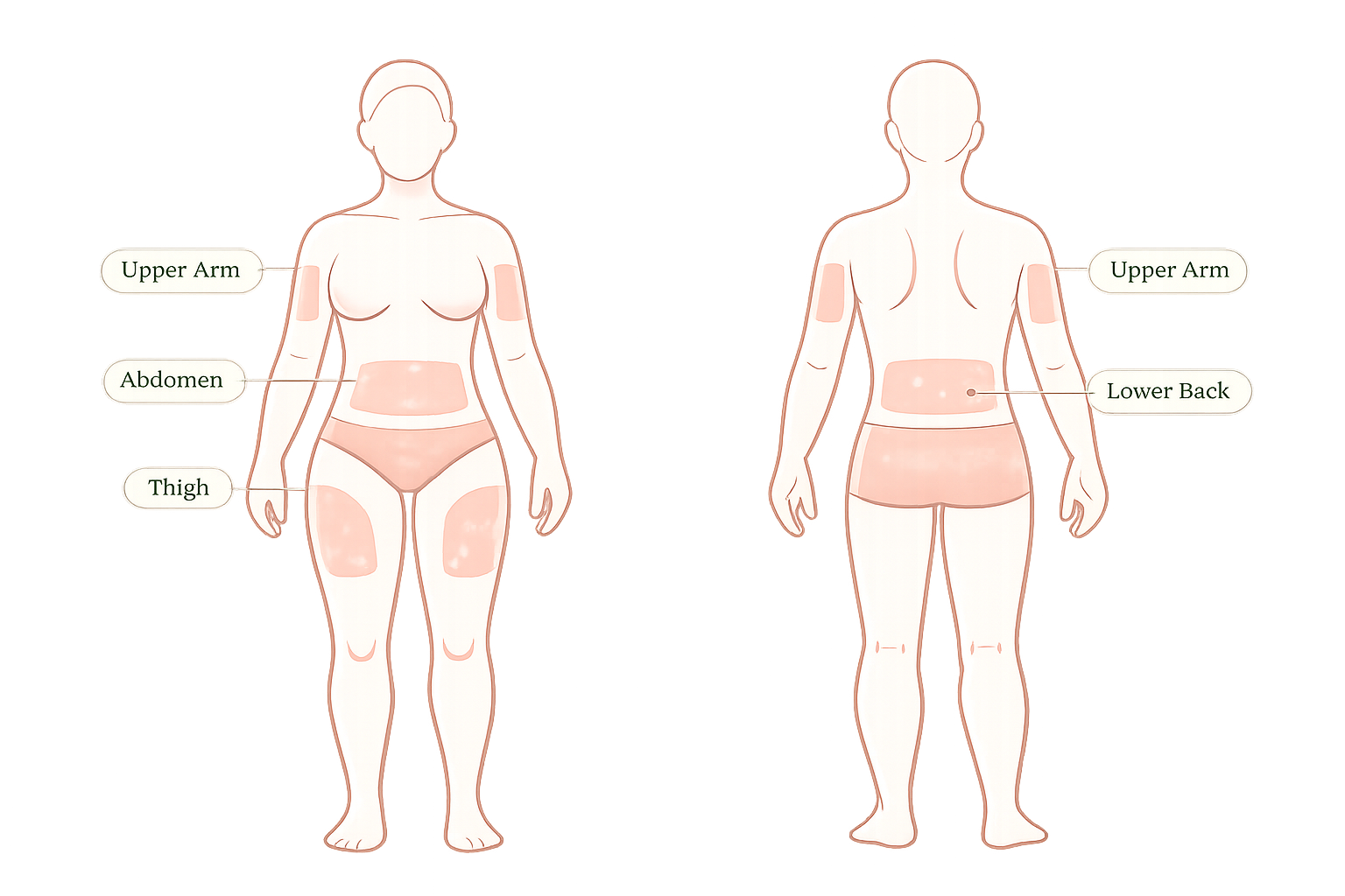 Subcutaneous Injection Sites